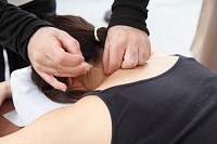 鍼治療をうける女性